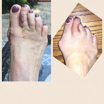 John R Senatore, DPM - Union Podiatry - Podiatrists Near Me - Towson, Maryland John R Senatore, DPM - Union Podiatry - Podiatrists Near Me - Towson, Maryland