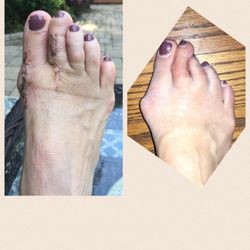 John R Senatore, DPM - Union Podiatry