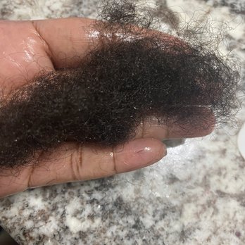 Nancy's Braids and Weaves - Hair loss from having braids in for 6 days - Hair Extensions Near Me - Doraville, Georgia