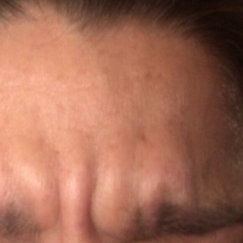 Essence Plastic and Reconstructive Surgery - Plastic Surgeons Near Me - Los Angeles, California Essence Plastic and Reconstructive Surgery - Plastic Surgeons Near Me - Los Angeles, California