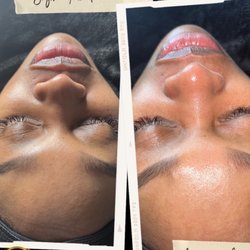 Sunflower Body Waxing