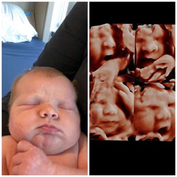 A New Image Baby - Newborn vs 34 week sonogram done by A New Image Baby - Diagnostic Imaging Near Me - Orlando, Florida A New Image Baby - Newborn vs 34 week sonogram done by A New Image Baby - Diagnostic Imaging Near Me - Orlando, Florida