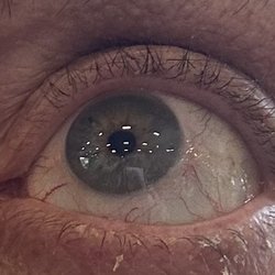 Bylsma Stephen MD - Let the eyes have it
