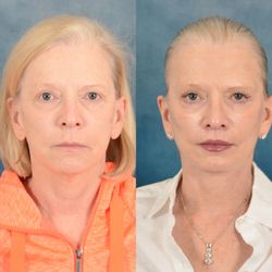 Starkman Facial Plastic & Laser Surgery