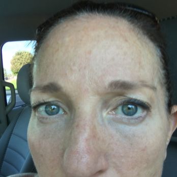 DermFx - Laser Hair Removal Near Me - Sunset Beach, California DermFx - Laser Hair Removal Near Me - Sunset Beach, California
