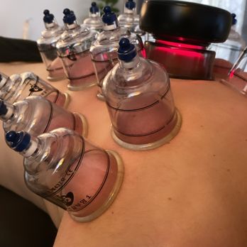 Essential Life Chiropractic & Wellness - Cupping Therapy - Chiropractors Near Me - Austin , Texas Essential Life Chiropractic & Wellness - Cupping Therapy - Chiropractors Near Me - Austin , Texas