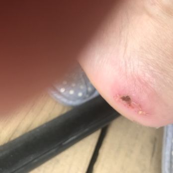 Nails of America - Pedicure pain and suffering! Couldn't pay me to go here again! - Nail Salons Near Me - Webster, Texas