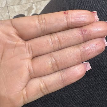 Luv's Nails - The hand she didn't clean after she did my nails from previous removing the dip color. - Nail Salons Near Me - Las Vegas, Nevada