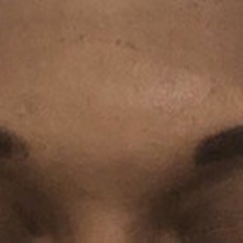 My Perfect Brows - The second day. My eyebrows were uneven with thick scabs. - Threading Services Near Me - Los Angeles, California
