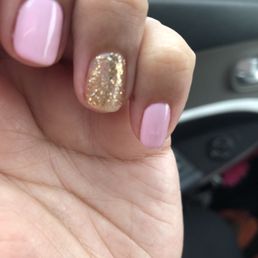 Bumps in pinky Bumps in pinky