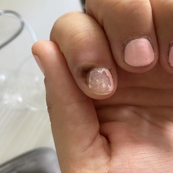 Blooming Nails - Cuticle infection - Nail Salons Near Me - Selden, New York
