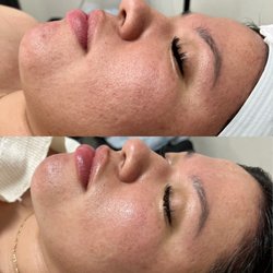 Nova Face and Body