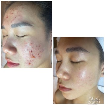 Yuna Skin & Body Solution - Skin Care Near Me - Johns Creek, Georgia Yuna Skin & Body Solution - Skin Care Near Me - Johns Creek, Georgia