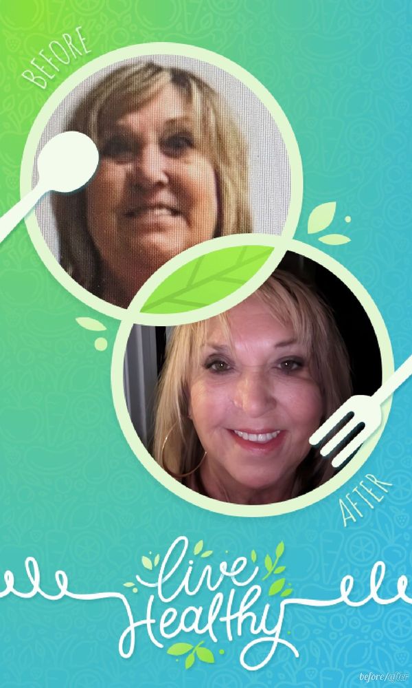 ALABAMA WEIGHT LOSS SURGERY Updated September 2024 13 Photos 52