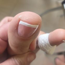 Queens Nail
