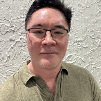Aeternia - Snatched jawline following Xerf procedure.  Repeat treatments will be needed to achieve and retain this look with more permanence. - Skin Care Near Me - Torrance, California