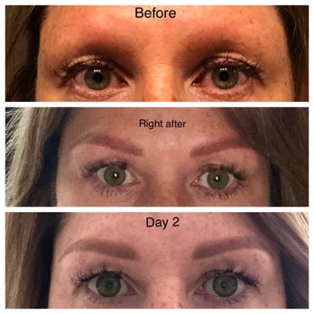 BrowGenius - Before, right after, day 2. - Skin Care Near Me - North Richland Hills, Texas