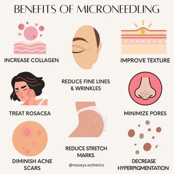 Renewal Esthetics - Estheticians Near Me - Weatherford, Texas Renewal Esthetics - Estheticians Near Me - Weatherford, Texas
