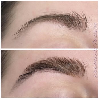 Waters Aesthetics - Skin Care Near Me - Phoenix, Arizona