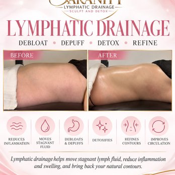 Saranity Lymphatic Drainage - Massage Therapy Near Me - Glenview, Illinois Saranity Lymphatic Drainage - Massage Therapy Near Me - Glenview, Illinois