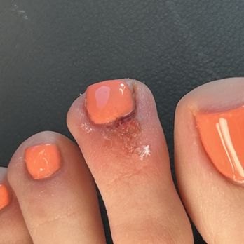 Vinpearl Spa - Glued my ripped skin back on - Nail Salons Near Me - Tujunga, California