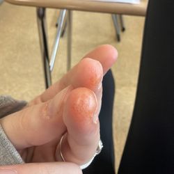 Eden Nails Spa - Reply to my previous review of what they caused me.