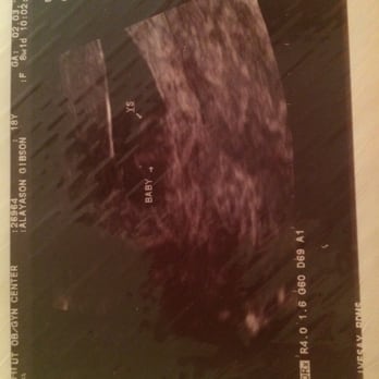 Pregnancy Resource Center TN - The one my OBGYN did, and labeled the yolk sac and baby. - Crisis Pregnancy Centers Near Me - Maryville, Tennessee