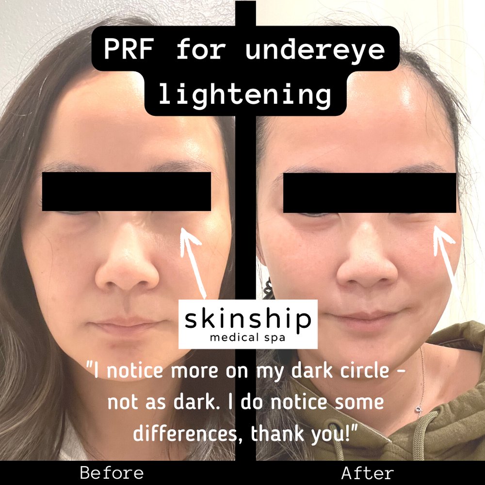 skinship medspa Logo