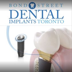 Bond Street Dental Implants