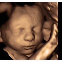 Pregnancy Treasures & Boutique - 28wk(+5day) 4D Ultrasound. Incredible imaging capabilities. The technology they have in-house paired with the labtech make the experience A+