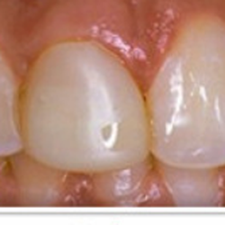 Raminder Singh, DDS - Elite Dental & Denture