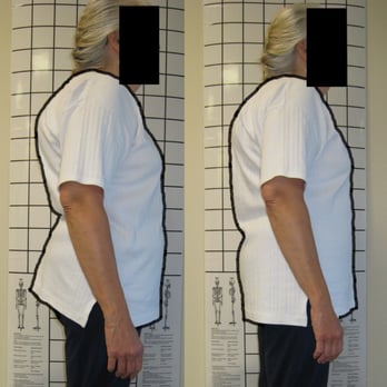 Best Body Moves - Left: 30 years of chiro & massage. Right: ONE Feldenkrais treatment for amazing results! - Massage Therapy Near Me - Gig Harbor, Washington