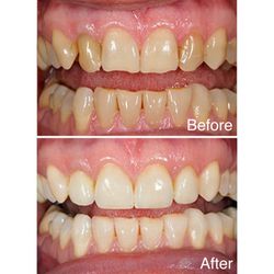 David Younan, DDS: Long Beach Dental Wellness