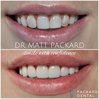 Packard Dental - Orthodontists Near Me - Carlsbad, California