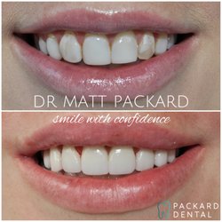 Packard Dental