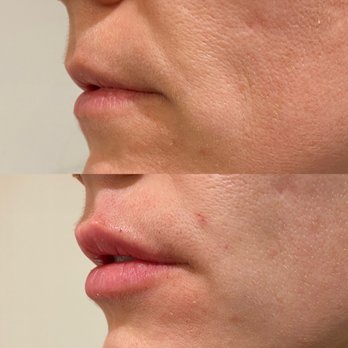 Stark Aesthetics - Medical Spas Near Me - Beverly Hills, California Stark Aesthetics - Medical Spas Near Me - Beverly Hills, California