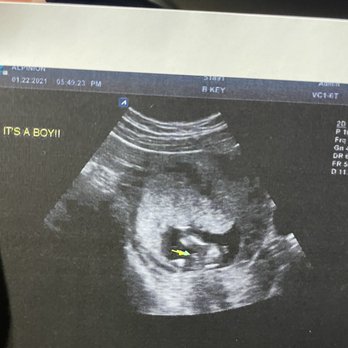 The Ultrasound Experience - Ultrasound Imaging Centers Near Me - San Marcos, California The Ultrasound Experience - Ultrasound Imaging Centers Near Me - San Marcos, California