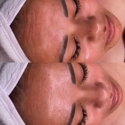 Leyva Skn - Natural "Botox" facial before and after see the deep lines reduce!