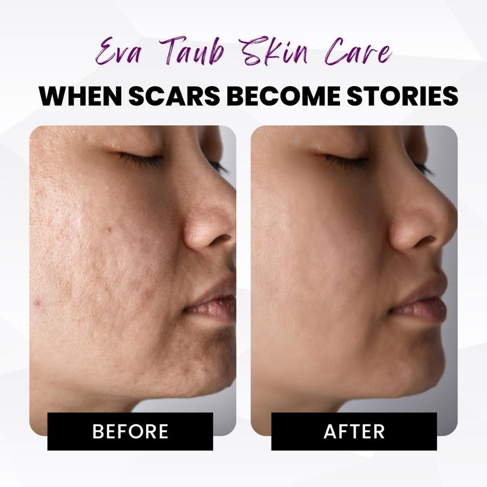 Eva Taub Skin Renewal Method Logo