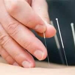 Lahaina Acupuncture - Orthopedic Acupuncture