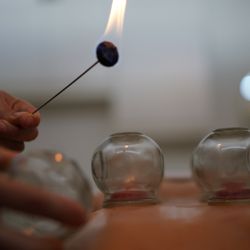 Essential Medicine - Fire Cupping