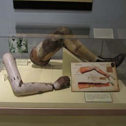 early prosthetic limbs