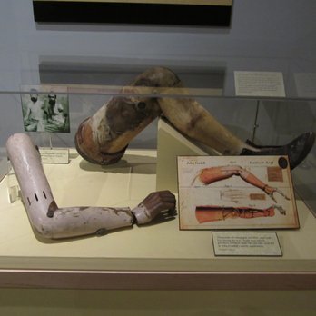 State Historical Museum - early prosthetic limbs - Landmarks & Historical Buildings Near Me - Des Moines, Iowa