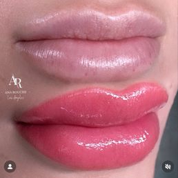 My lips look great now. My lips look great now.