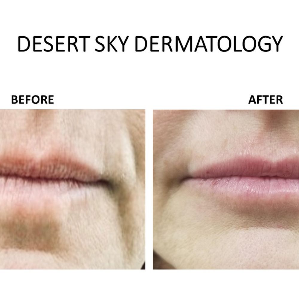 Desert Sky Dermatology - Dermatologists Near Me - Gilbert, Arizona