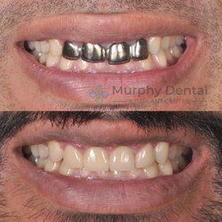 Murphy Dental and Implant Center