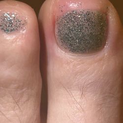 Heavenly Nails and Spa - Over-trimmed toenail