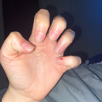 Molinas Nails - So much blood. - Nail Salons Near Me - West Bloomfield Township, Michigan