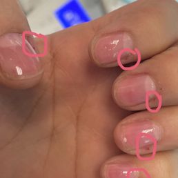 Was cut on all 10 finger during a manicure Was cut on all 10 finger during a manicure