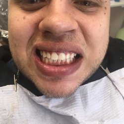 Andrew R. Strickland DMD - Plainville Family Dental - After